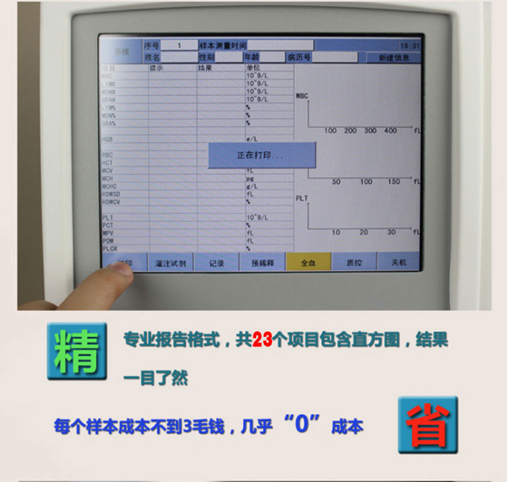 血液分析仪细节图