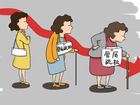 超声波骨密度检测仪厂家提示骨密度下降怎么办？如何恢复？